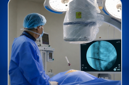 ĐAU CỘT SỐNG KÉO DÀI, NGƯỜI ĐÀN ÔNG 29 TUỔI PHÁT HIỆN LAO CỘT SỐNG NHỜ KỸ THUẬT SINH THIẾT CỘT SỐNG QUA CUỐNG CUNG
