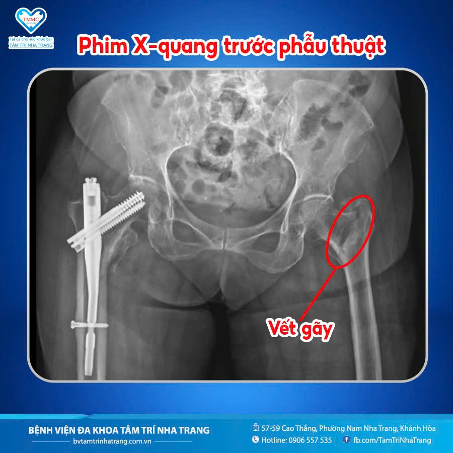 95638b5e39c9b697efd8