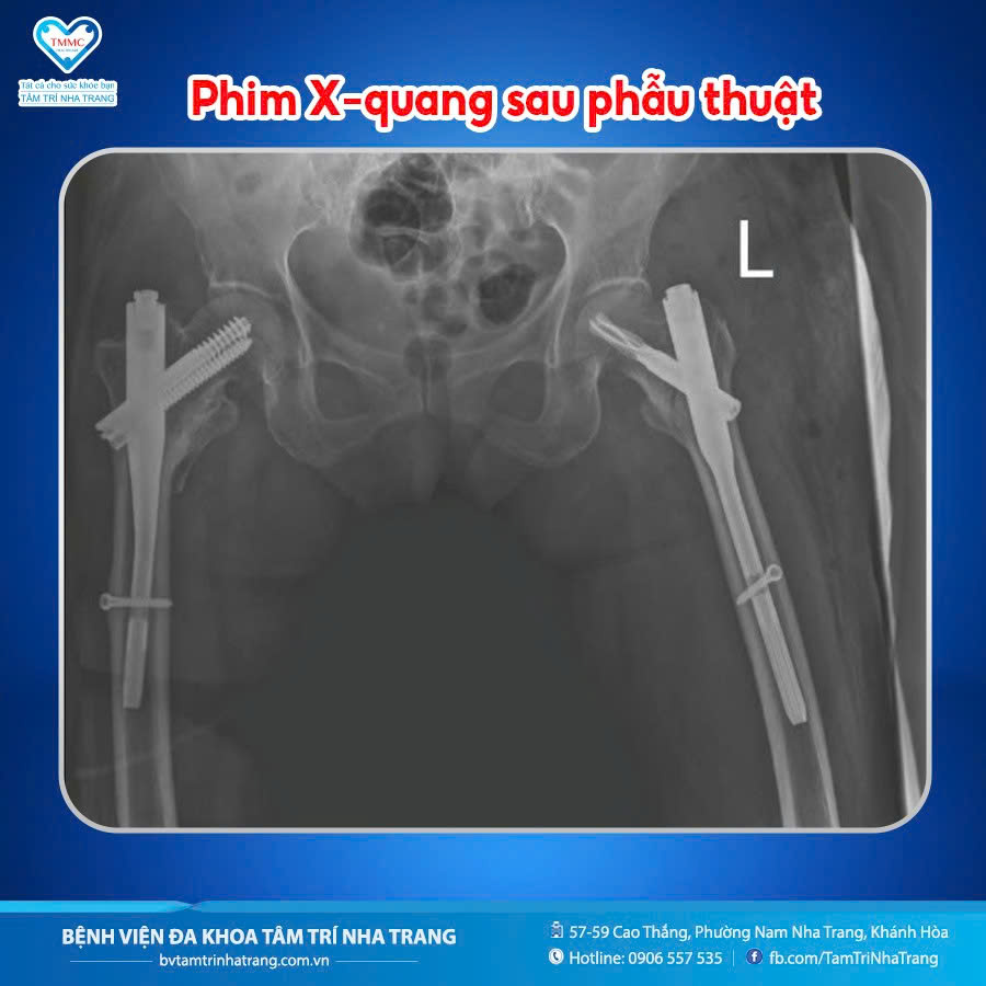 eee5fdd84f4fc011995e