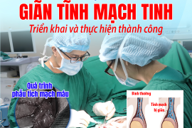 KỸ THUẬT PHẪU THUẬT GIÃN TĨNH MẠCH TINH – ĐƯỢC TRIỂN KHAI THÀNH CÔNG TẠI BVĐK TÂM TRÍ NHA TRANG