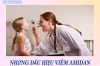 VIÊM AMYDAL – TRIỆU CHỨNG MẮC BỆNH Ở TRẺ XIN ĐỪNG CHỦ QUAN