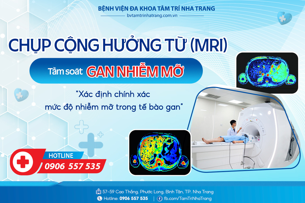 MRI_gan_nhiYm_mY