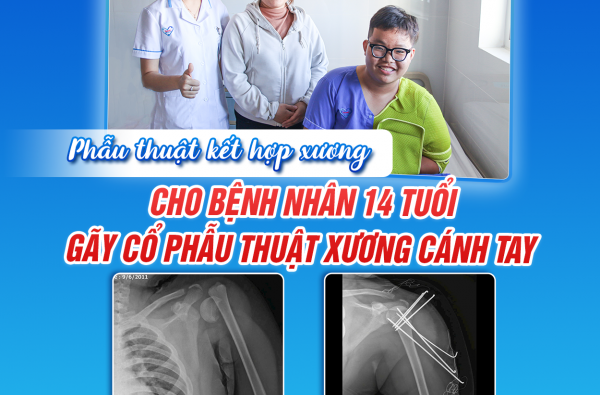 PHẪU THUẬT KẾT HỢP XƯƠNG CHO BỆNH NHÂN 14 TUỔI GÃY CỔ PHẪU THUẬT XƯƠNG CÁNH TAY