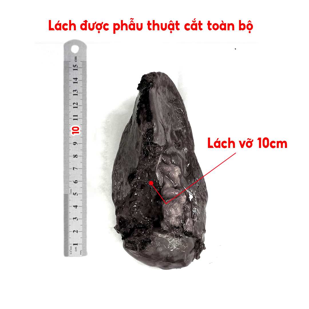 8dabadc8efeb61b538fa