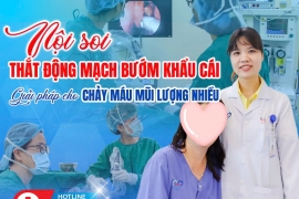 ​NỘI SOI THẮT ĐỘNG MẠCH BƯỚM KHẨU CÁI – GIẢI PHÁP CHO CHẢY M.A.U MŨI LƯỢNG NHIỀU