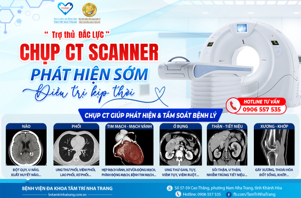 “Trợ thủ đắc lực”- CHỤP CT SCANNER  PHÁT HIỆN SỚM, ĐIỀU TRỊ KỊP THỜ