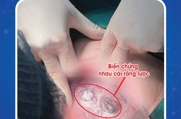 PHẪU THUẬT BẢO TỒN TỬ CUNG THÀNH CÔNG SẢN PHỤ BỊ NHAU CÀI RĂNG LƯỢC HIẾM GẶP