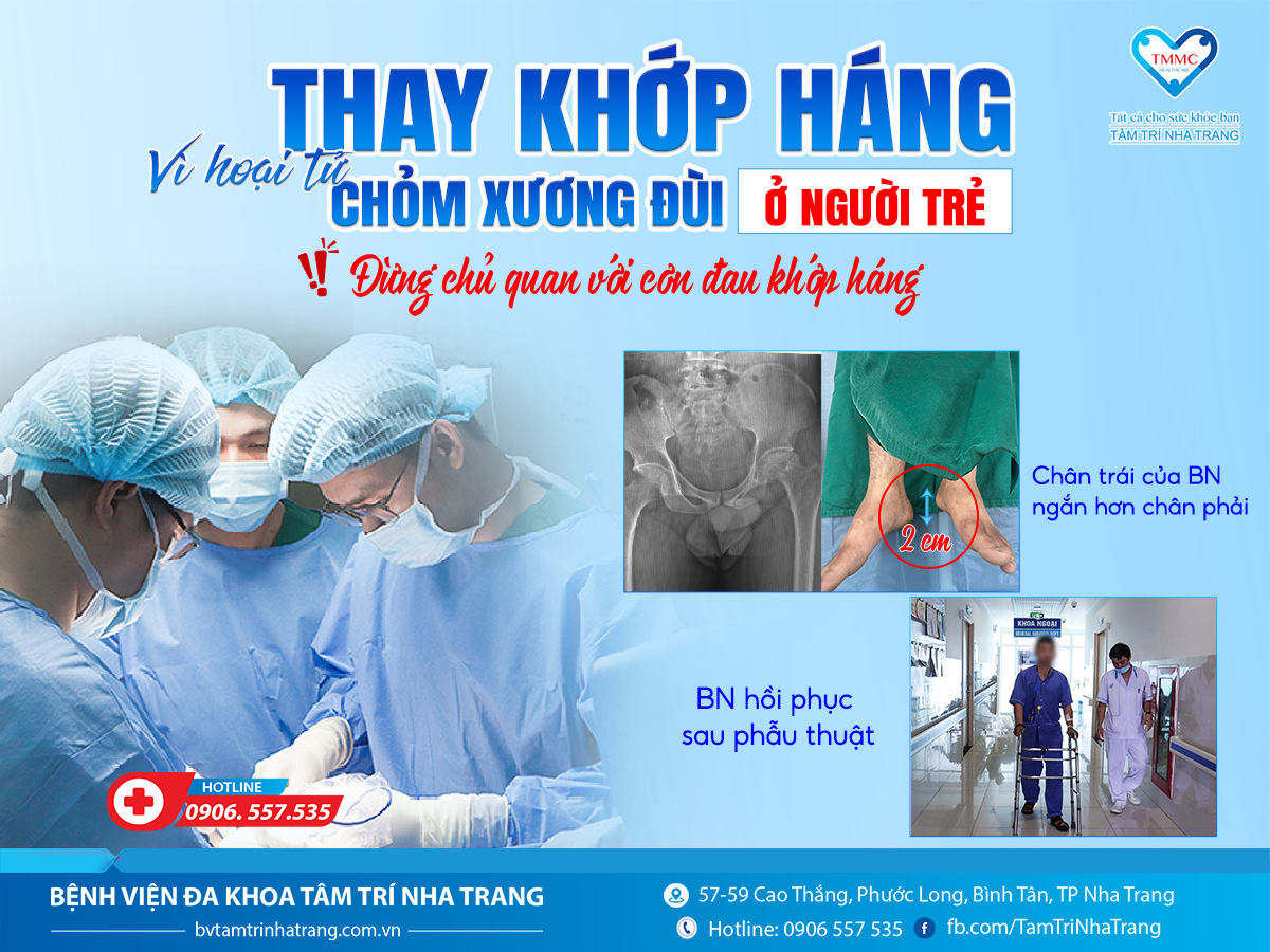 05.2025_CA_THAY_KHYP_HANG