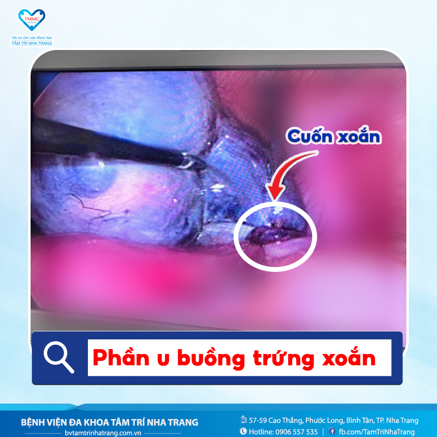 poster_bac_nguyen_q
