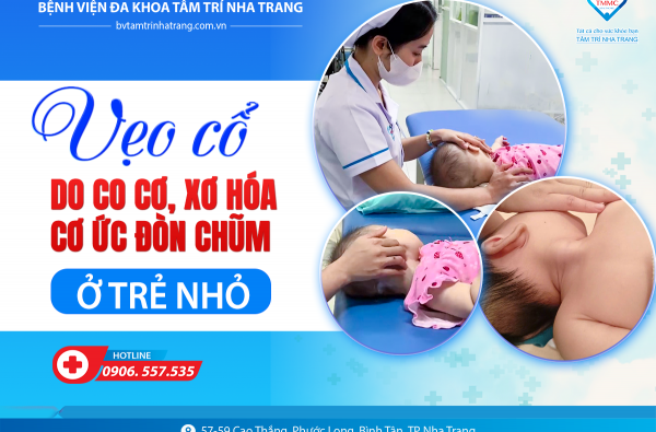 VẸO CỔ DO CO CƠ, XƠ HÓA CƠ ỨC ĐÒN CHŨM Ở TRẺ - HIỂU ĐÚNG – PHÁT HIỆN SỚM – ĐIỀU TRỊ KỊP THỜI