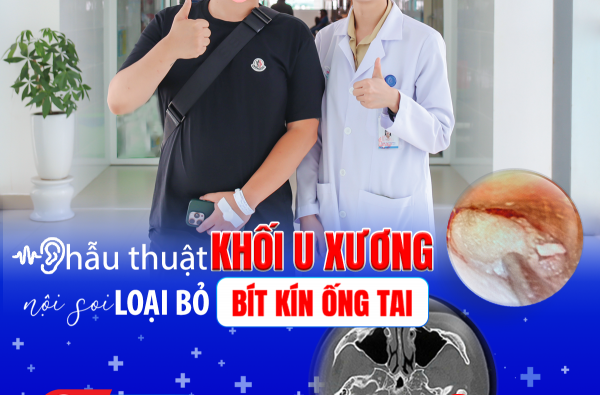 PHẪU THUẬT NỘI SOI LOẠI BỎ KHỐI U XƯƠNG BÍT KÍN ỐNG TAI