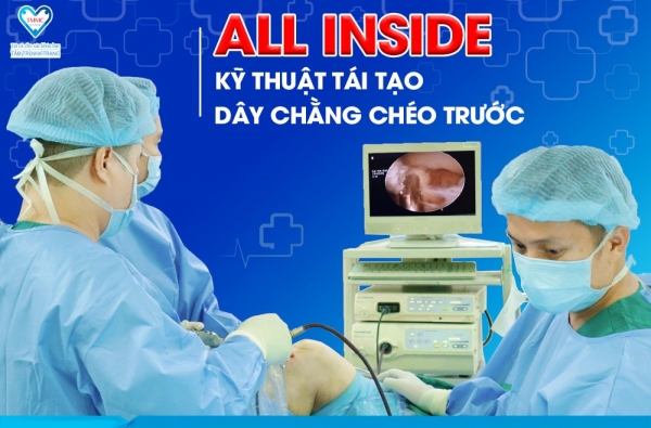 ALL INSIDE - KỸ THUẬT TÁI TẠO DÂY CHẰNG CHÉO TRƯỚC