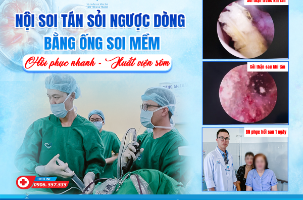 NỘI SOI TÁN SỎI NGƯỢC DÒNG BẰNG ỐNG SOI MỀM – HỒI PHỤC NHANH – XUẤT VIỆN SỚM