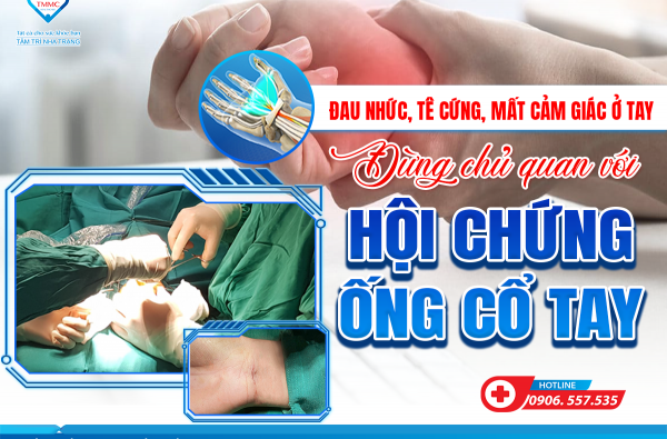 ĐAU NHỨC, TÊ CỨNG, MẤT CẢM GIÁC Ở TAY– ĐỪNG CHỦ QUAN VỚI HỘI CHỨNG ỐNG CỔ TAY!