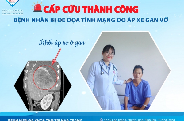 CẤP CỨU THÀNH CÔNG BỆNH NHÂN BỊ ĐE DỌA TÍNH MẠNG DO ÁP XE GAN VỠ