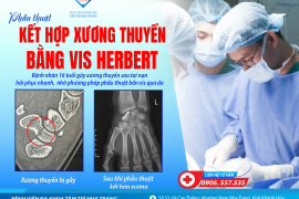 PHẪU THUẬT KẾT HỢP XƯƠNG THUYỀN BẰNG VIS HERBERT - ÍT XÂM LẤN - PHỤC HỒI NHANH