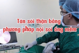 SIÊU CUỐN’ Cận cảnh quá trình tán sỏi thận bằng nội soi ống mềm tại BVĐK Tâm Trí Nha Trang