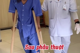 sau 2 ngày phẫu thuật gãy liên mấu chuyển xương đùi, bệnh nhân đã hồi phục tích cực.