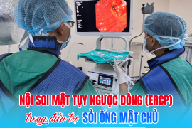 ĐIỀU TRỊ THÀNH CÔNG SỎI ỐNG MẬT CHỦ BẰNG KỸ THUẬT NỘI SOI MẬT TỤY NGƯỢC DÒNG (ERCP)