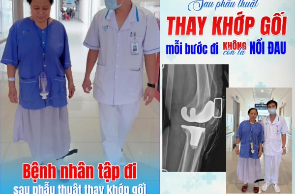 NHỮNG BƯỚC ĐI KHÔNG CÒN LÀ NỖI ĐAU… SAU PT THAY KHỚP GỐI 
