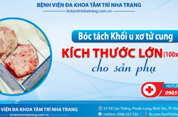 BÓC TÁCH KHỐI U XƠ TỬ CUNG KÍCH THƯỚC LỚN 100X80MM CHO SẢN PHỤ