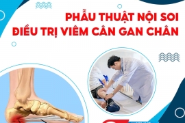 PHẪU THUẬT NỘI SOI ĐIỀU TRỊ VIÊM CÂN GAN CHÂN