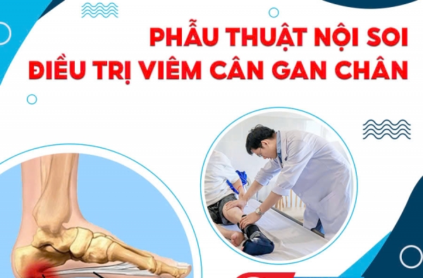 PHẪU THUẬT NỘI SOI ĐIỀU TRỊ VIÊM CÂN GAN CHÂN