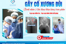 GÃY CỔ XƯƠNG ĐÙI, BỆNH NHÂN HAI LẦN THAY KHỚP HÁNG TOÀN PHẦN - TRỌN VẸN NIỀM TIN, TRỌN VẸN HÀNH TRÌNH HỒI PHỤC