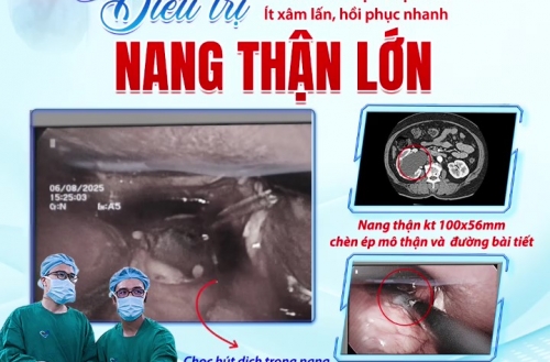 PHẪU THUẬT NỘI SOI ĐIỀU TRỊ NANG THẬN LỚN - ÍT XÂM LẤN, HỒI PHỤC NHANH