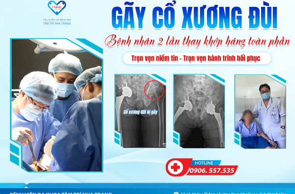 GÃY CỔ XƯƠNG ĐÙI, BỆNH NHÂN HAI LẦN THAY KHỚP HÁNG TOÀN PHẦN - TRỌN VẸN NIỀM TIN, TRỌN VẸN HÀNH TRÌNH HỒI PHỤC