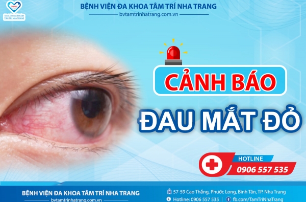 CẢNH BÁO TÌNH TRẠNG ĐAU MẮT ĐỎ