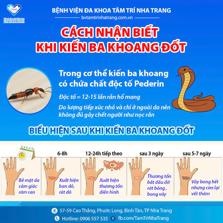 KiYn_ba_khoang_1