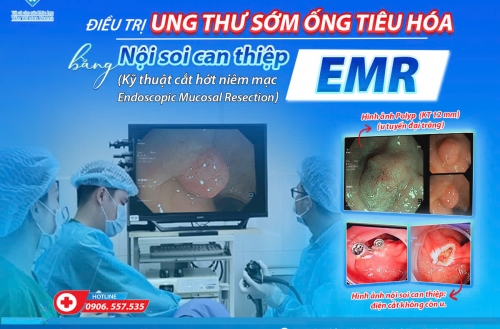 ĐIỀU TRỊ UNG THƯ SỚM Ở ỐNG TIÊU HÓA BẰNG NỘI SOI CAN THIỆP CẮT HỚT NIÊM MẠC - EMR