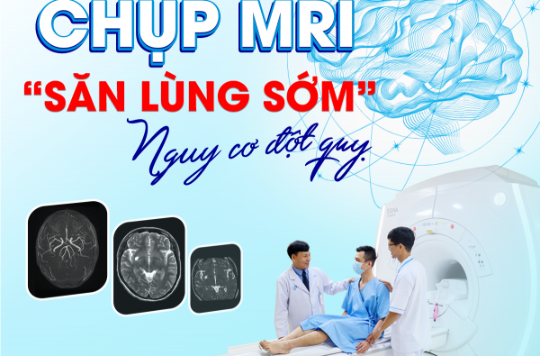 CHỤP MRI - 