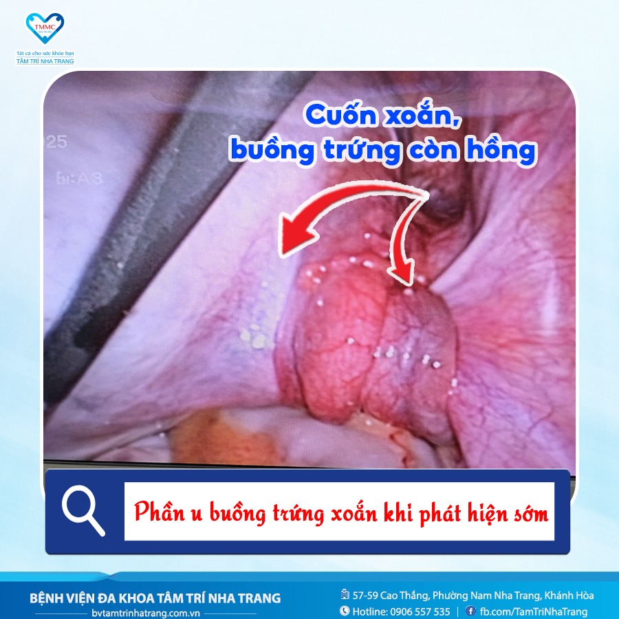 u_buYng_trYng_xoYn_2