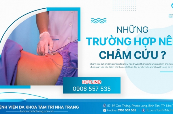 NHỮNG TRƯỜNG HỢP NÊN CHÂM CỨU?