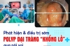 PHÁT HIỆN VÀ ĐIỀU TRỊ SỚM POLYP ĐẠI TRÀNG “KHỔNG LỒ” QUA NỘI SOI