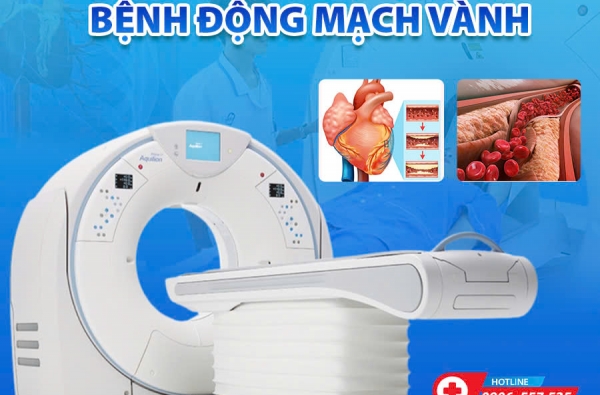 TẦM SOÁT BỆNH ĐỘNG MẠCH VÀNH – BẢO VỆ TIM MẠCH, NGĂN NGỪA BIẾN CHỨNG