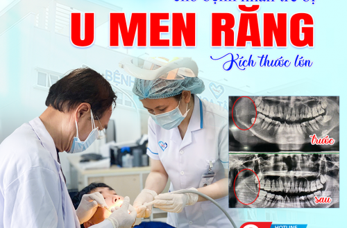 GIỮ LẠI KHUÔN MẶT CHO BỆNH NHÂN TRẺ MẮC U NGUYÊN BÀO MEN KÍCH THƯỚC LỚN