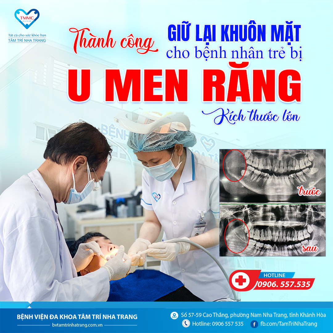 u_men_rYng