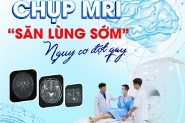 CHỤP MRI - "SĂN LÙNG" SỚM NGUY CƠ ĐỘT QUỴ