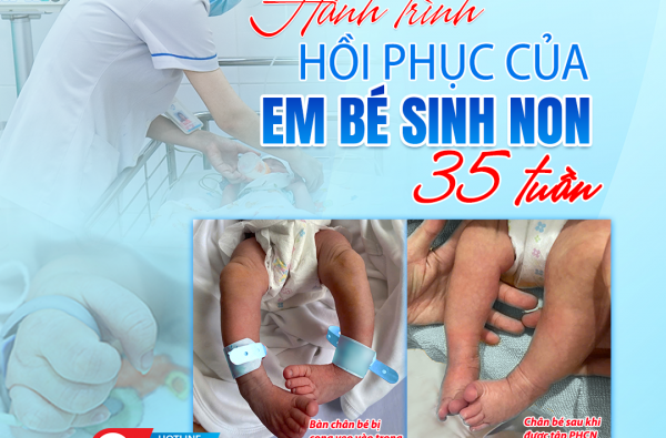  HÀNH TRÌNH HỒI PHỤC CỦA EM BÉ SINH NON 35 TUẦN 