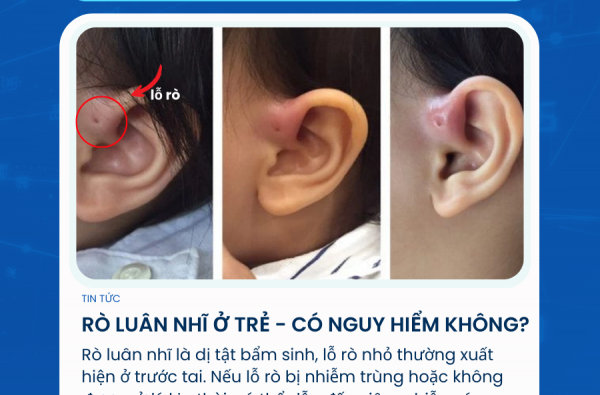 RÒ LUÂN NHĨ Ở TRẺ –  CÓ NGUY HIỂM KHÔNG?