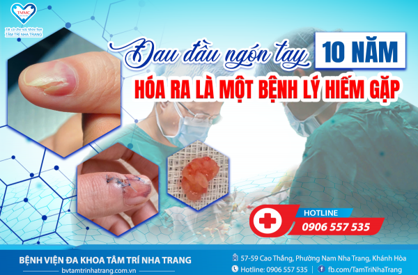 ĐAU ĐẦU NGÓN TAY SUỐT 10 NĂM – HÓA RA LÀ MỘT BỆNH LÝ HIẾM GẶP