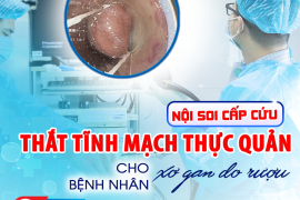 NỘI SOI CẤP CỨU THẮT TĨNH MẠCH THỰC QUẢN CHO BỆNH NHÂN XƠ GAN DO RƯỢU