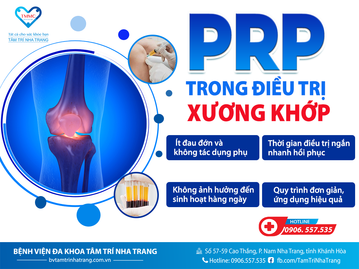 TIEM_PRP